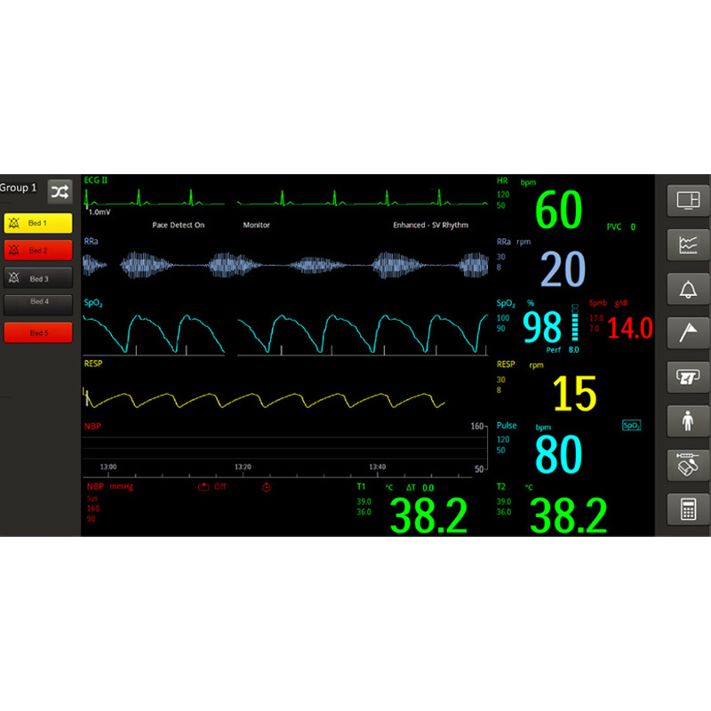 Монитор пациента Philips Efficia CM12
